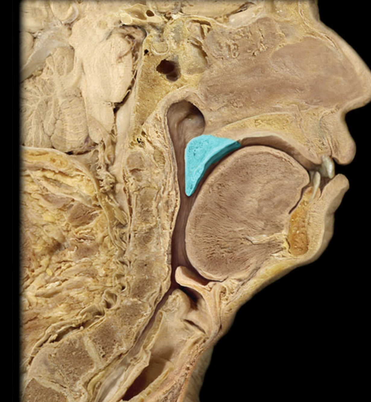 term image