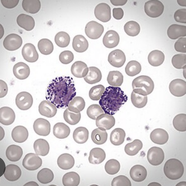 <p>Basophils increase in what conditions?</p>