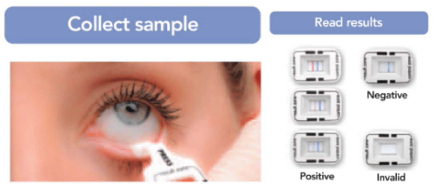 <p>10 minute diagnostic test that quantitatively measures MMP 9 activity by taking a sample from the lower palpebral conjunctiva. Will produce a positive test result when MMP 9 levels are >40.</p>