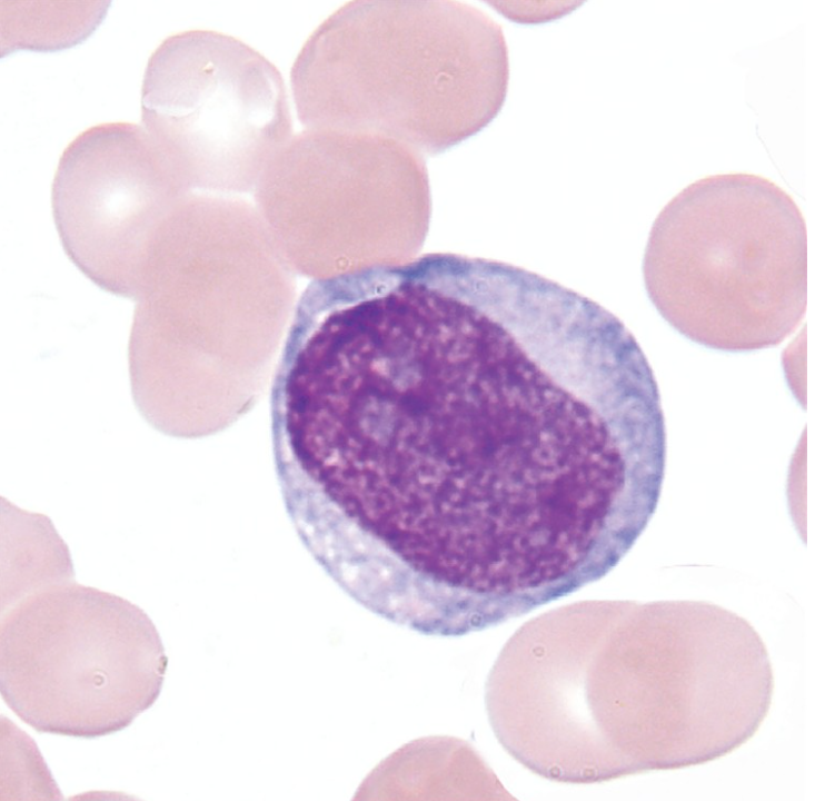 <p>What WBC precursor is this?</p>
