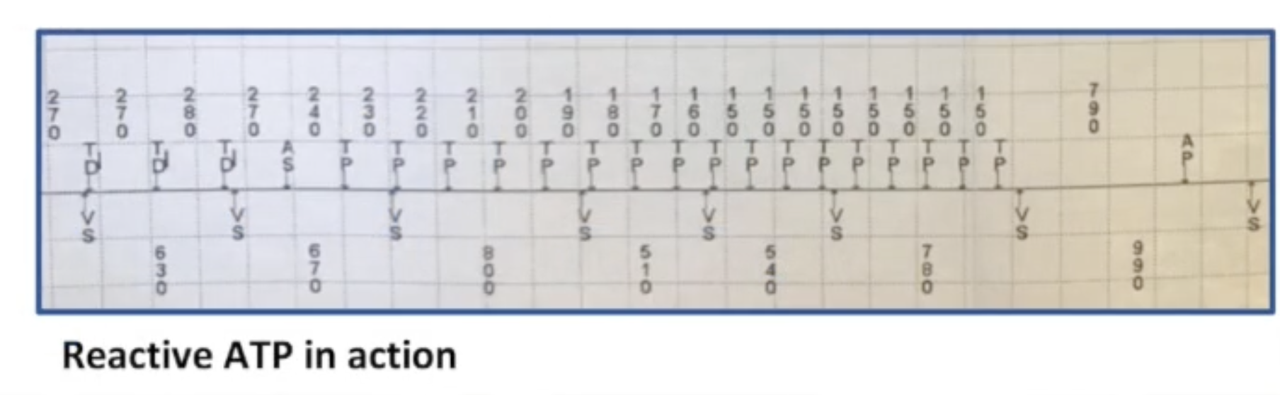 <ul><li><p>ATP in the atrium</p></li><li><p>Works best for regular, monomorphic, reentrant</p></li><li><p>Unlikely to work for AF</p></li><li><p>Risks: trigger VT, transient AV block, increase patient symptoms</p></li><li><p>More aggressive than normal burst</p><ul><li><p>Ramp</p></li><li><p>Burst+</p></li><li><p>Reactive ATP</p></li></ul></li></ul><p></p>