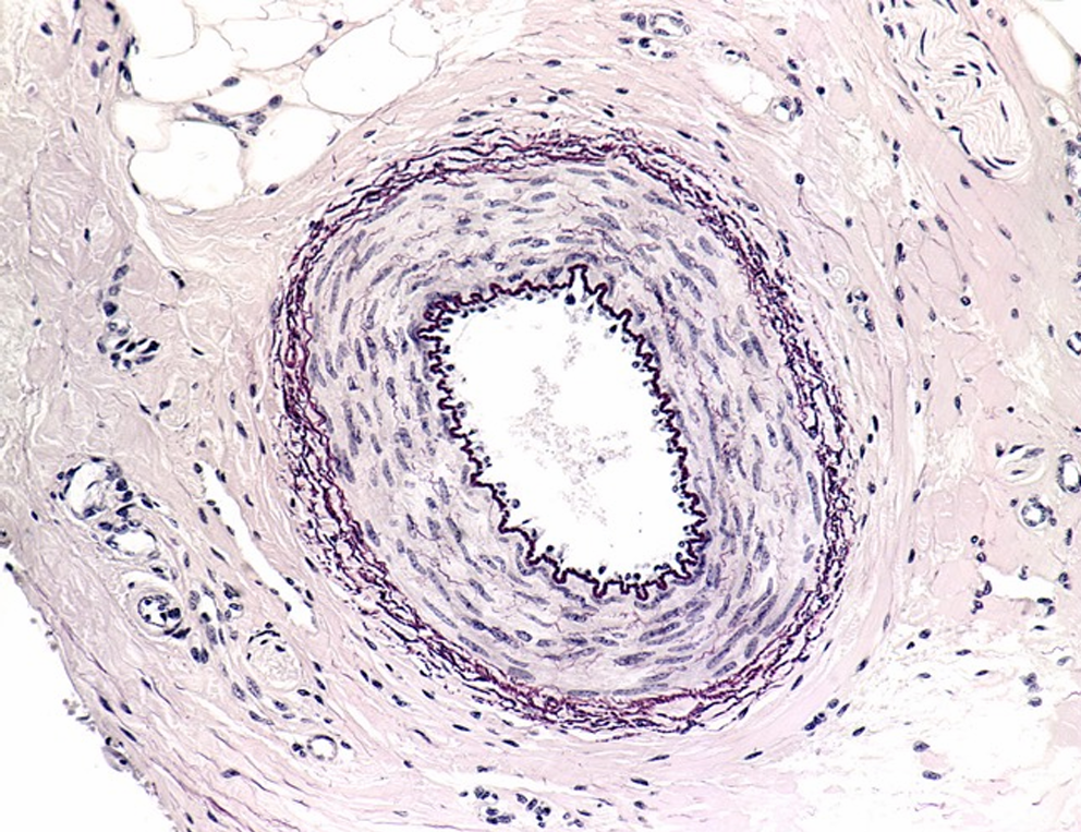 <p>type bloedvat</p>