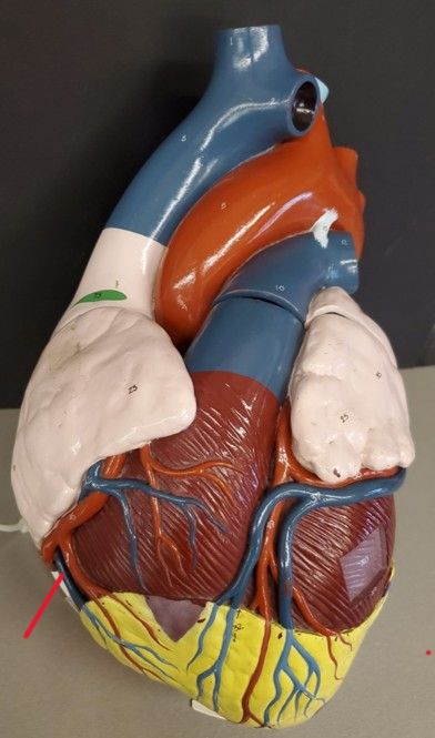 <p>Name the vein</p>