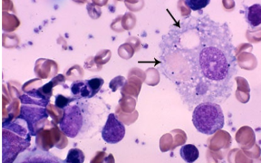 <p>inflammation response</p><p>Phagocytize cell debris, foreign material, and infectious agents</p><p>Secretion of inflammatory cytokines to recruit other inflammatory cells </p>