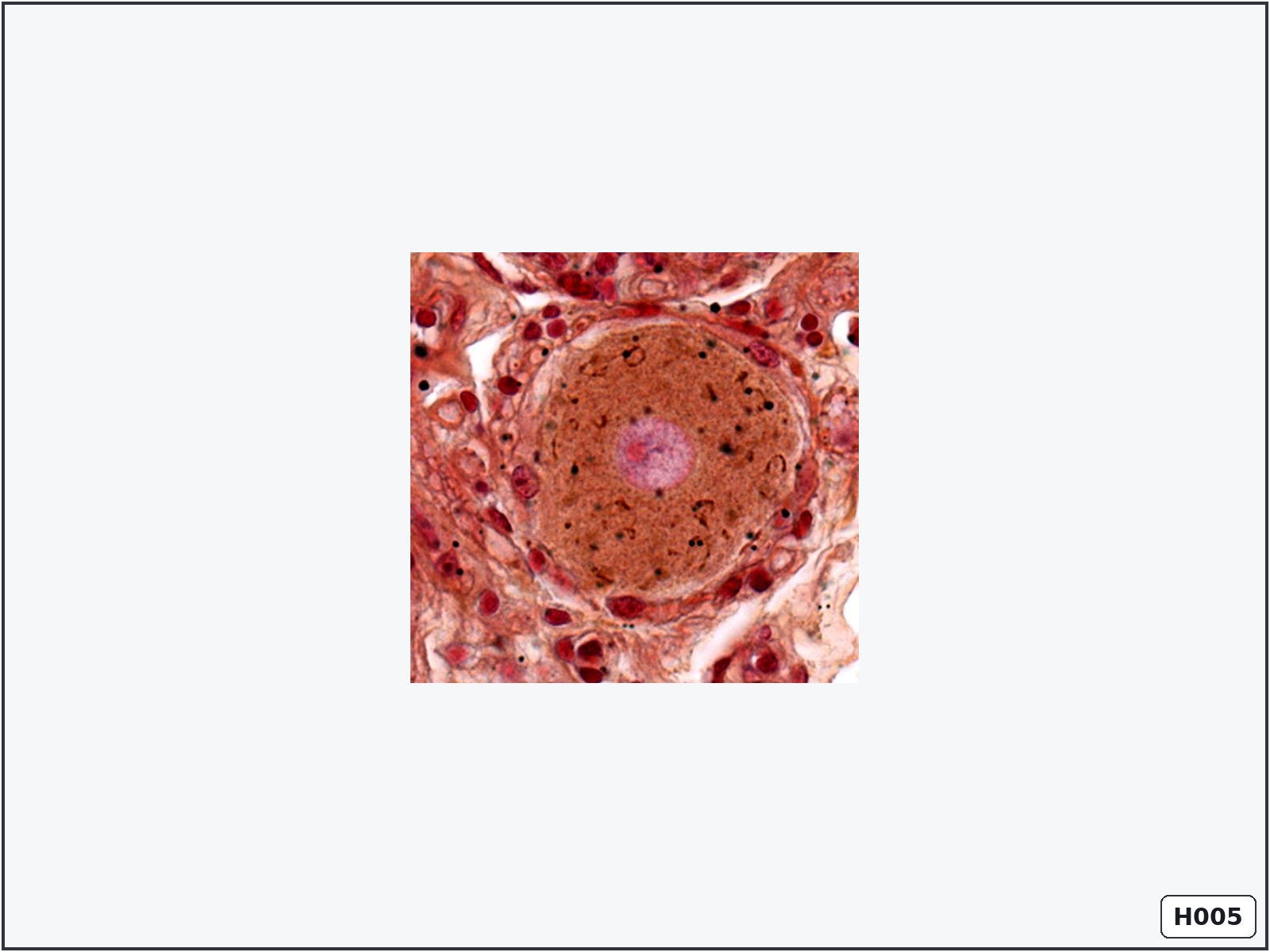 term image