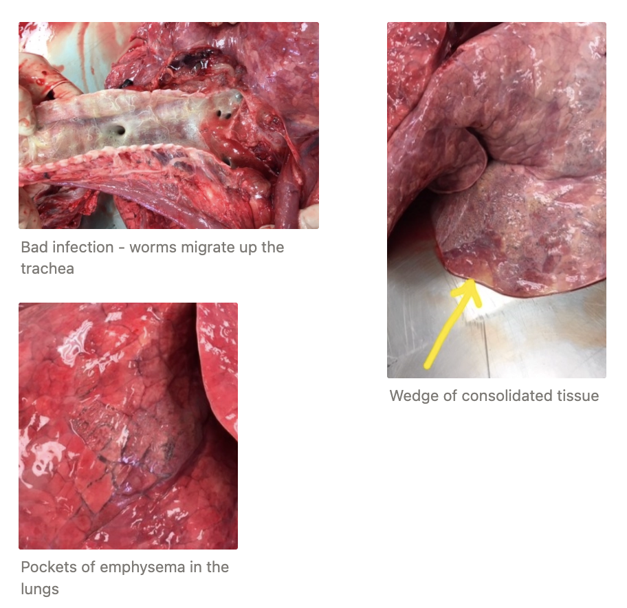 <p><u>Signalment:</u> Calves <10m (esp. dairy calves)</p><ul><li><p>Less common due to widespread use of anthelmintics to treat GI parasites</p></li><li><p>Infection common, disease uncommon due to strong immune response to migrating parasites</p></li></ul><p><u>Seasonality:</u> Late summer and autumn</p><ul><li><p>Sporadic outbreaks of disease due to unique epidemiological factors that allows naive animals to be suddenly exposed to huge numbers of infective [[L3]]</p></li></ul><p><u>Clinical Signs:</u> 3w post-infection of [L3] → Verminous pneumonia</p><ol><li><p>Coughing, tachypnoea and dyspnoea (“Husk”)</p></li><li><p>Weight loss</p></li><li><p>Death</p></li><li><p>± 2˚&nbsp;bronchopneumonia</p></li></ol><p><u>Treatment:</u> ALL common drugs (no AR)</p><ul><li><p>LA ML injectables #1</p></li></ul><p><u>Prevention:</u> NONE! Farmer does not think about <em>D. viviparus</em> as killed with more important GI nematodes</p><ul><li><p>Huskvac vaccine = Irradiated L3 PO x2 doses 4w apart before being turned onto pasture in UK</p></li></ul><p></p>