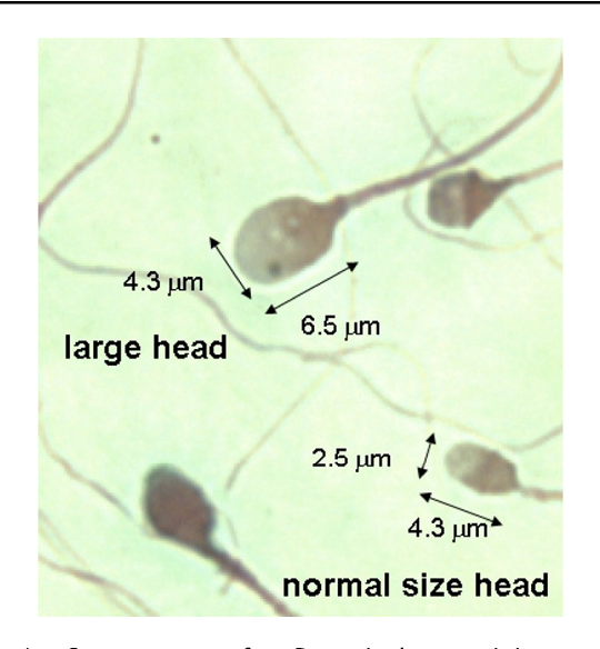 <p>Giant Head sperm</p>