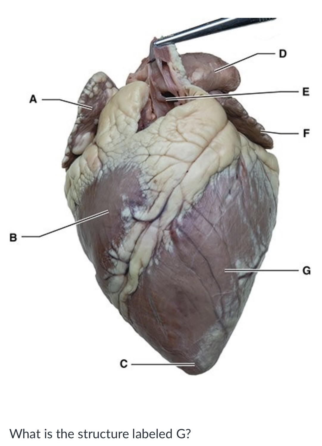 <p><span>Left ventricle</span></p><p><span>Auricle of the right atrium</span></p><p><span>Right ventricle</span></p><p><span>Auricle of the left atrium</span></p>