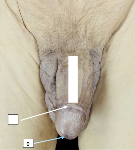 <p>Identify</p><p>Side Question:</p><p>This is an opening in which corpus of the penis?</p><p>This is found at?</p><p>What exits in this structure?</p>