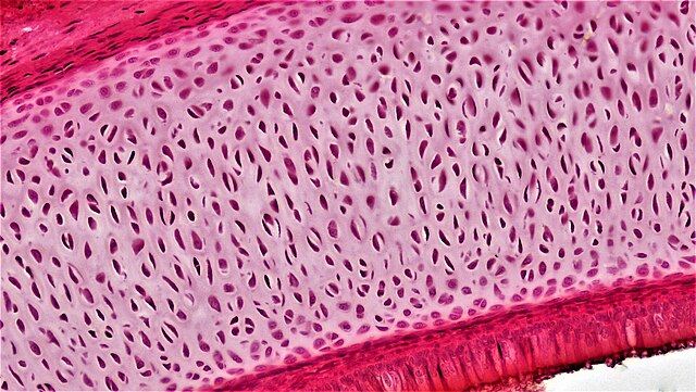 <p>hyaline cartilage </p>