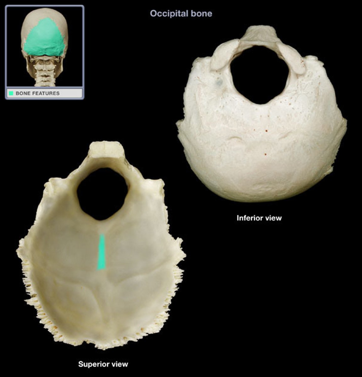 <p>What is this boney feature?</p>