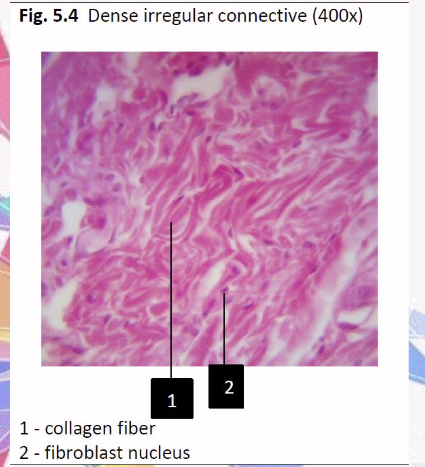 <p>dense irregular connective</p><p>areas that need strength against pulling dif directions</p><p>skin, organ covering etc.</p>