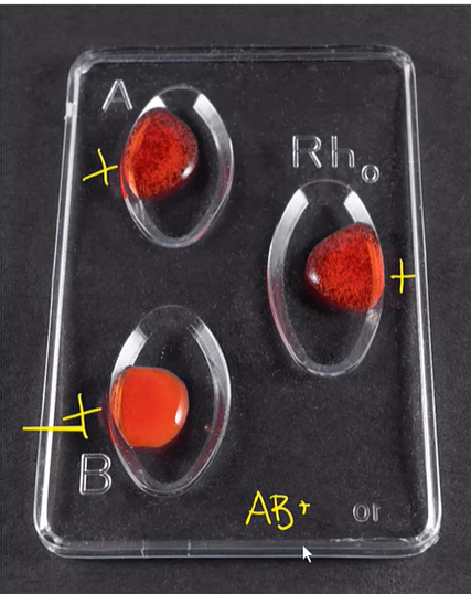 <p>AB-POS</p>