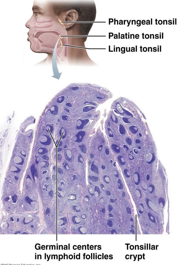 <p><strong>MALT — Tonsils</strong></p><ul><li><p>What does MALT stand for?</p><ul><li><p>What are the tonsils?</p></li></ul></li></ul><p></p>
