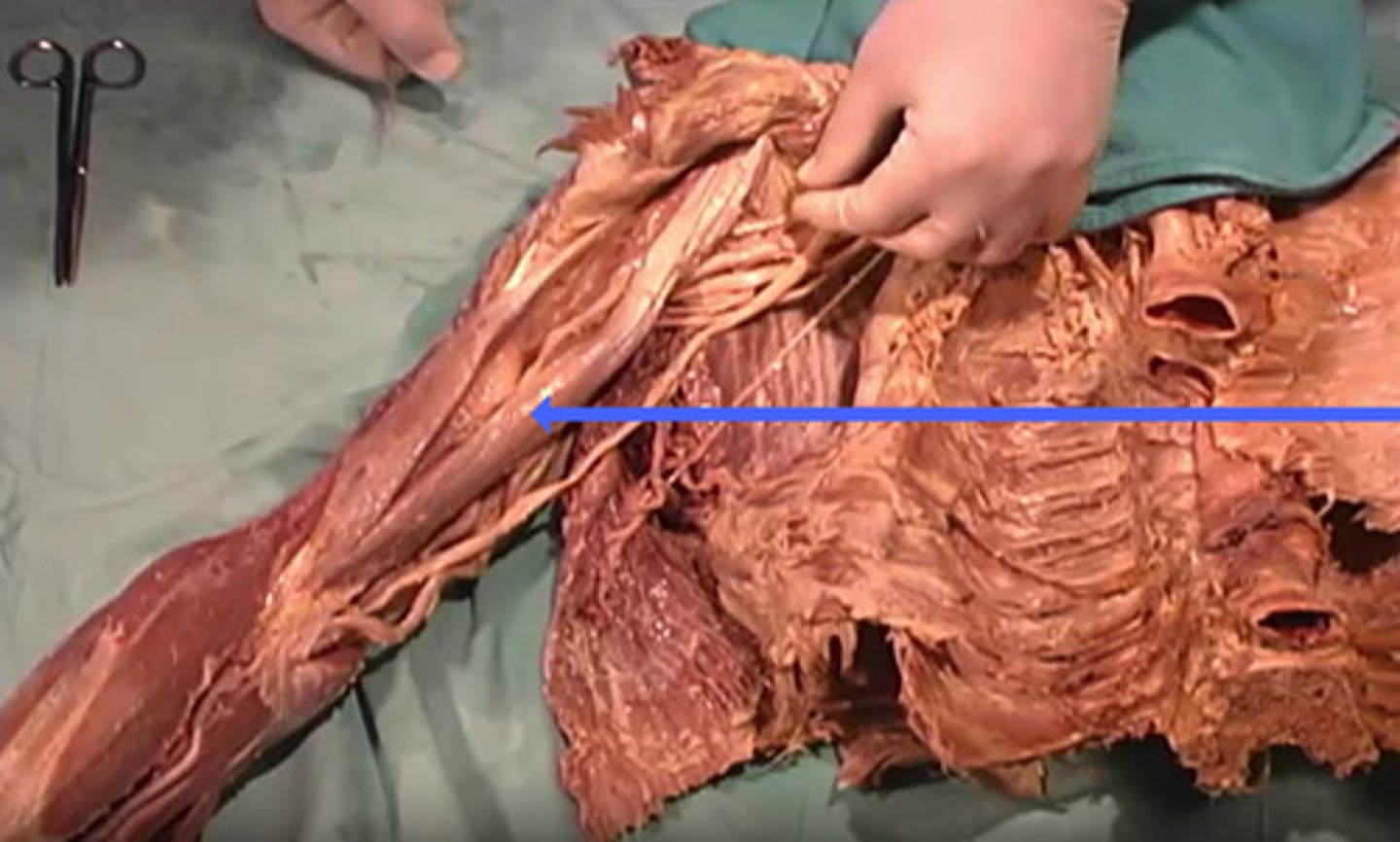 <p>What is the name of this muscle as indicated by the arrow?</p>