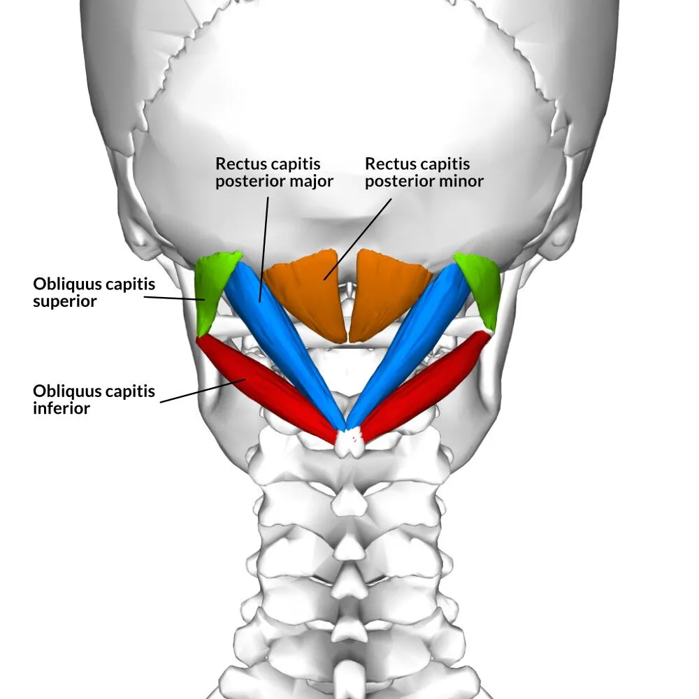<p>Suboccipital Group - <strong>Obliquus capitis inferior </strong>Origin </p>