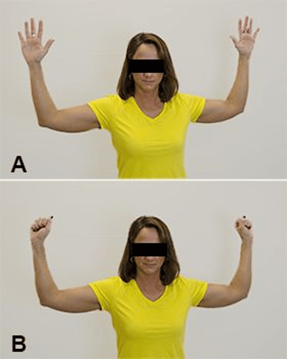 <p>1,1</p><p>1. The Roos Test, shown in the photographs, is used to test for the presence of thoracic outlet syndrome. The Adson Test is also used to test for thoracic outlet syndrome.</p><p>2. The Empty Can Test is used to assess for rotator cuff tear. The Roos Test, shown in the photographs, is used to test for the presence of thoracic outlet syndrome.</p><p>3. The Roos Test, shown in the photographs, is used to test for the presence of thoracic outlet syndrome. A positive Cervical Compression Test is more suggestive of other pathologies, including disc herniation, nerve root irritation, or vertebral fractures, but not thoracic outlet syndrome.</p><p>4. The Roos Test is used to test for the presence of thoracic outlet syndrome. AC joint palpation tests for AC joint involvement</p>