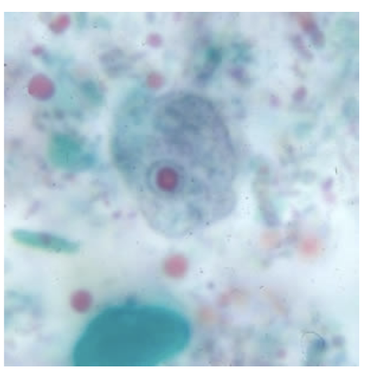 <p>-6-10 microns</p><p>-Hard to distinguish from Iodamoeba buetschlii</p>