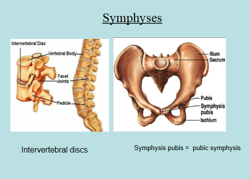 <ul><li><p>No joint cavity</p></li><li><p>Synchondroses → cartilaginous joints with bones connected by hyaline cartilage</p><ul><li><p>Functional Class: Synarthrotic Joints</p></li><li><p>Example: Epiphyseal plates (composed of hyaline cartilage connecting the diaphysis and epiphyses of a long bone)</p></li></ul></li><li><p>Symphyses → cartilaginous joints with bones connected by fibrocartilage</p><ul><li><p>Functional Class: Amphiarthrotic Joints</p></li><li><p>Examples: Intervertal discs, pubic symphysis, etc</p></li></ul></li></ul><p></p>