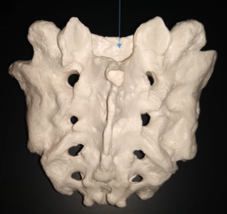 <p>What is this opening?</p>