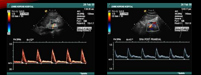 <p>which one is pre - prandial &amp; Post - prandial </p>