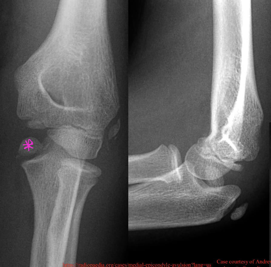 <p>What is the dx</p>