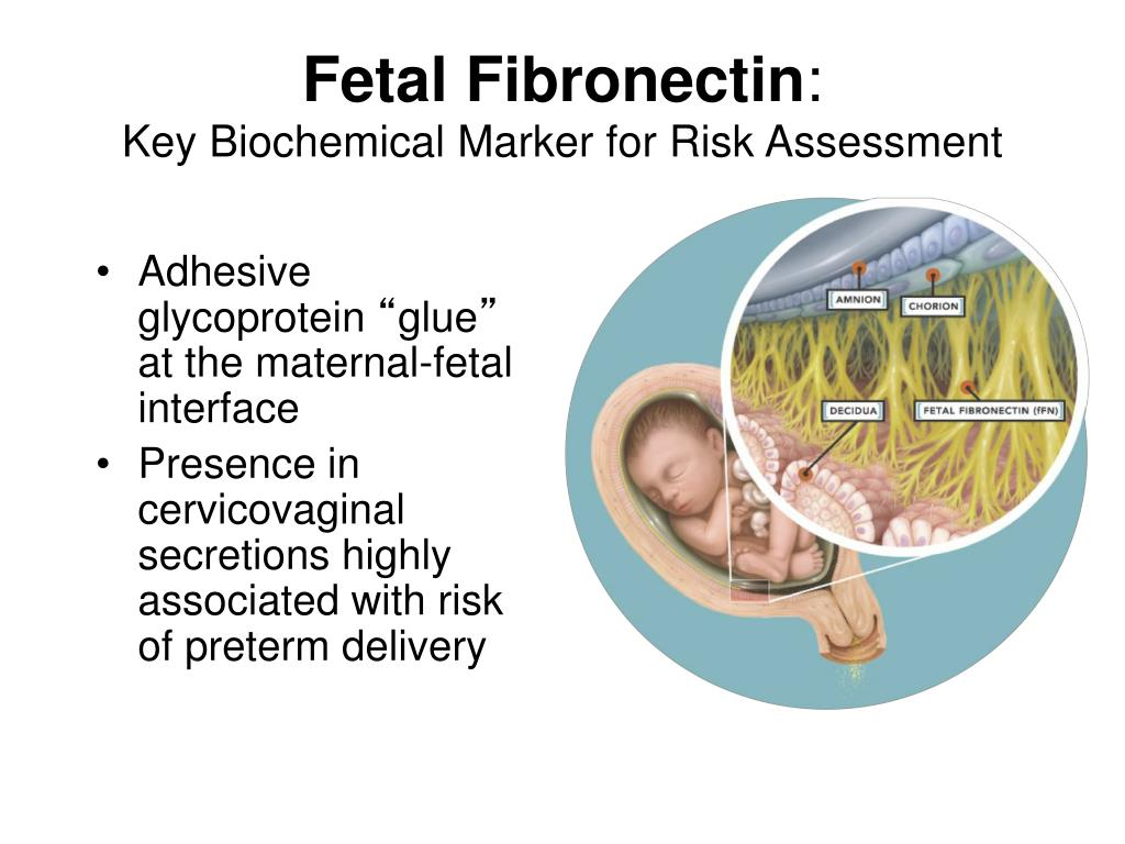 <p><mark data-color="#feffed" style="background-color: rgb(254, 255, 237); color: inherit;">regular uterine contractions that cause cervical changes </mark><span style="color: rgb(234, 83, 83);"><strong><mark data-color="#feffed" style="background-color: rgb(254, 255, 237); color: inherit;">b4 37 weeks</mark></strong></span></p><ol><li><p><span style="color: rgb(37, 136, 48);"><strong>Fetal Fibronectin Test</strong></span> (fFN): looks for presence of the <strong>protein </strong>which acts like “<strong>glue</strong>” bw fetal membranes and uterine lining (vaginal swab)</p></li><li><p>NST</p></li><li><p>BPP/USN</p></li></ol><p></p>