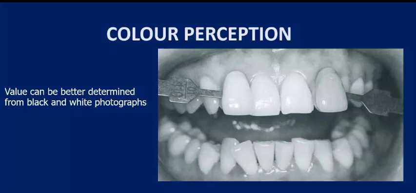 <p>clinicians take photographs using black and white filter</p><p>in hue they are correct, but using black and white, one of the teeth has a better match as it has more lightness </p>