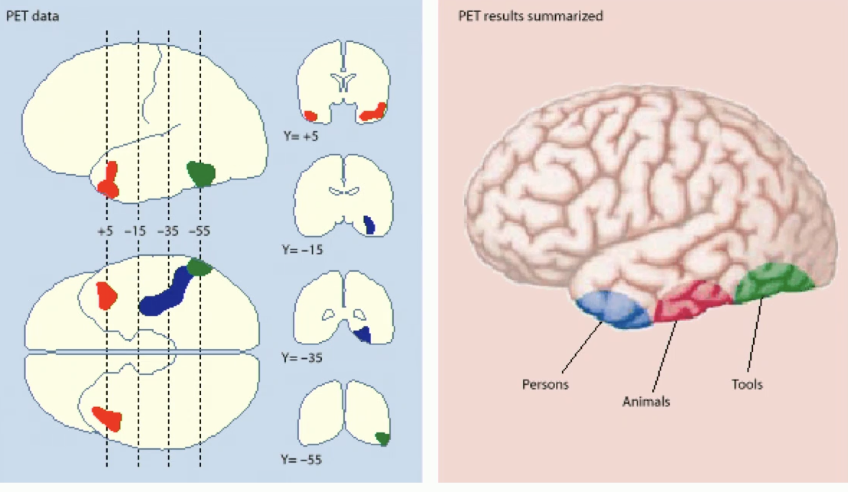 <ul><li><p>if you show people words of colors → activates ventral, posterior color regions like v4</p></li><li><p>if you show people action words like swim → activates more dorsal, posterior temporal regions that code more for actions</p></li><li><p>if you read action words involving a body party, you’re going to get activation in the motor strip that corresponds to movement of that body part</p></li></ul><p></p><p>people noticed early on from lesion patients that sometimes people present with <strong>categorical anomias</strong></p><ul><li><p><u>categorical anomia</u> → inability to name objects in specific categories</p></li><li><p>deficits naming tools, animals, and people go from posterior to anterior temporal cortex</p><ul><li><p>people → most anterior</p></li><li><p>animals → in the middle</p></li><li><p>tools → most posterior</p></li></ul></li><li><p>similar type of topography observed with PET scanning of healthy subjects</p></li></ul><p>this suggests that there is some type of segregation of this information in the ventral temporal cortex</p><p></p><p></p>
