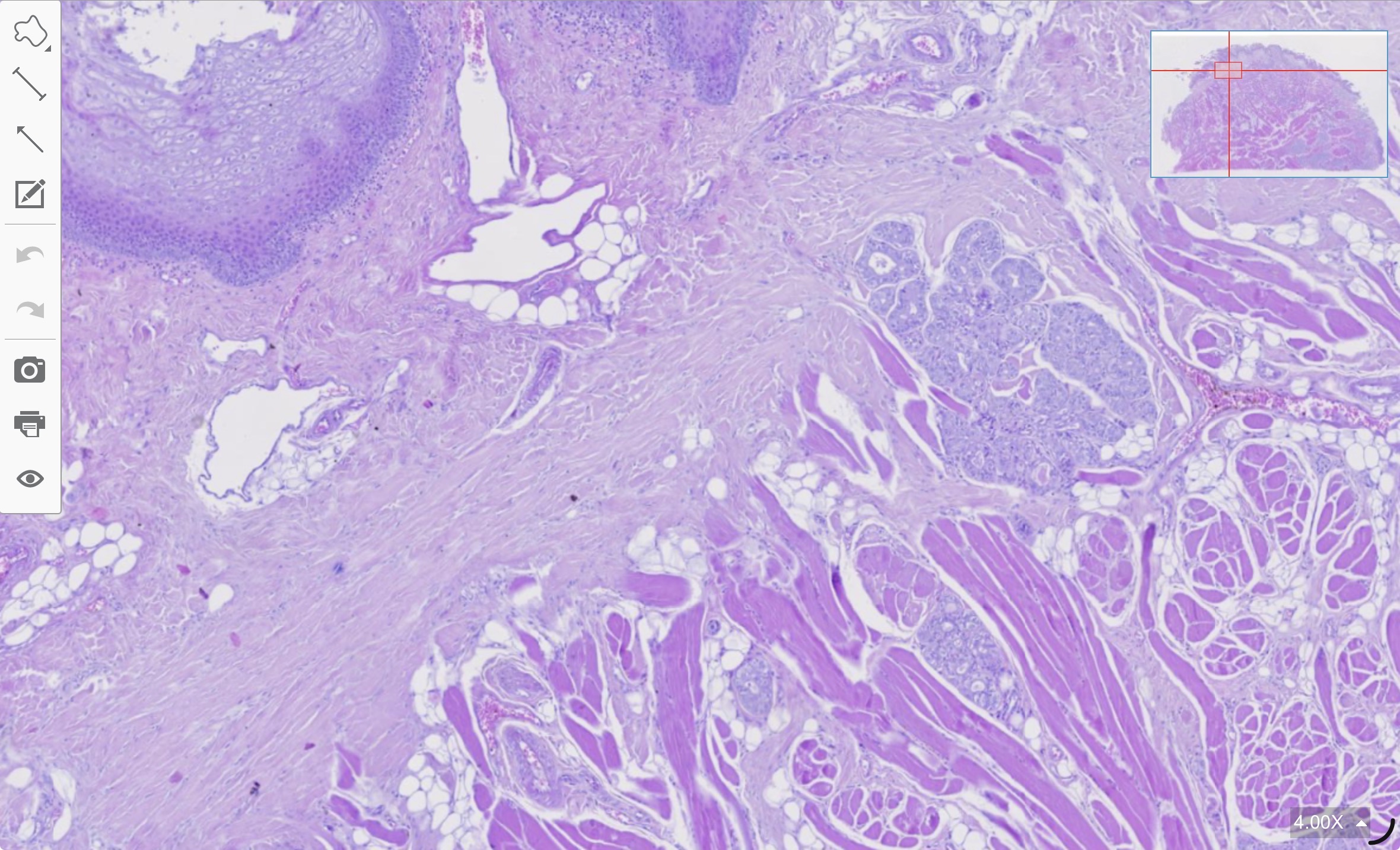 term image