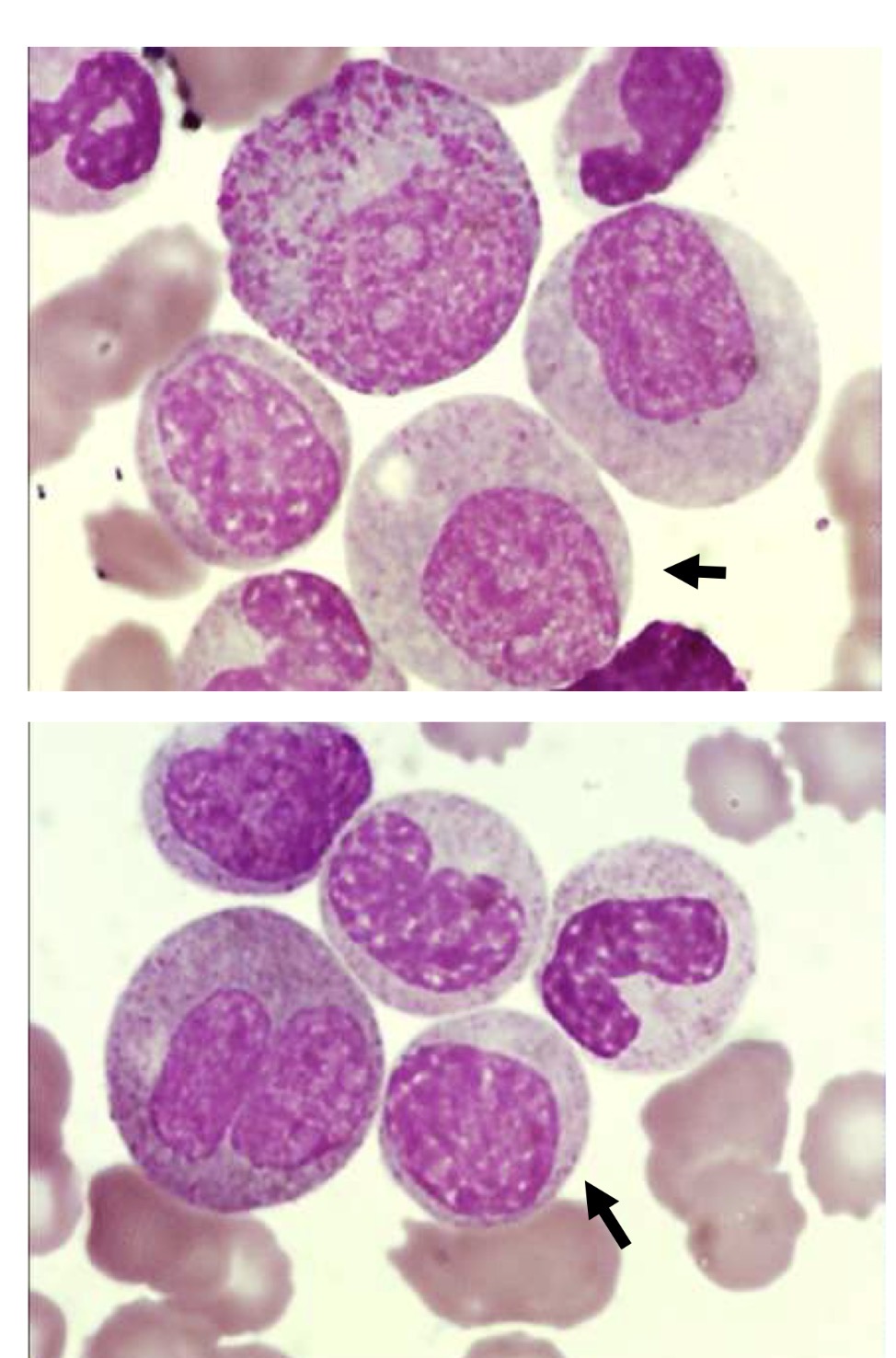 <p>Name this cell and the main points for identification</p>