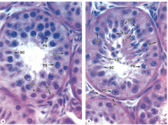 <p>What type of cells are Sertoli cells and where are they located?</p>