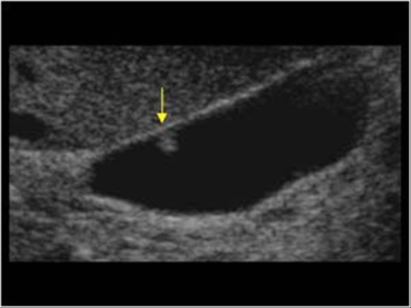 <p>Name findings and diagnosis</p>