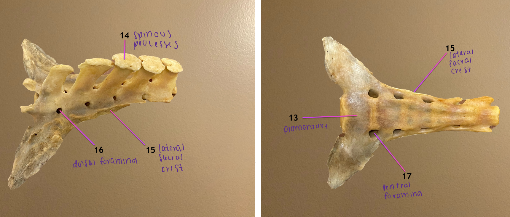 <p>sacrum</p><p>.</p><ol start="13"><li><p>promontory of sacrum</p></li><li><p>spinous processes of sacrum</p></li><li><p>lateral sacral crest: formed by transverse processes</p></li><li><p>dorsal foramina </p></li><li><p>ventral foramina </p></li></ol><p></p>