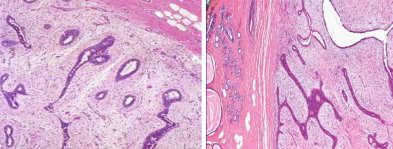<p>Are there two different pathologies? If you think yes, identify the one on the right vs the one on the left</p>