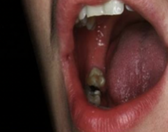 <ol start="16"><li><p>Identify the finding shown.</p></li></ol><p></p>