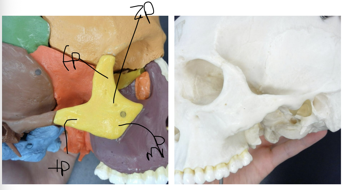 <p>frontal process of the zygomatic bone</p>