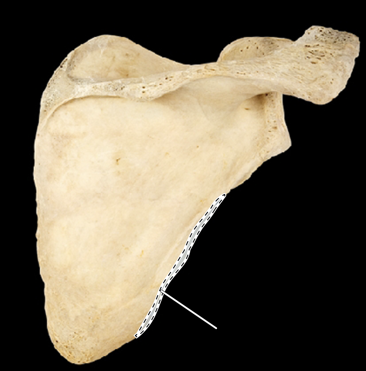 <p>posterior view</p>
