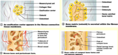 <p>- calvaria and facial skeleton</p><p>- most skull bones form from dense CT membranes</p><p>- ossification centers develop and edges of bony plates grow toward each other</p>