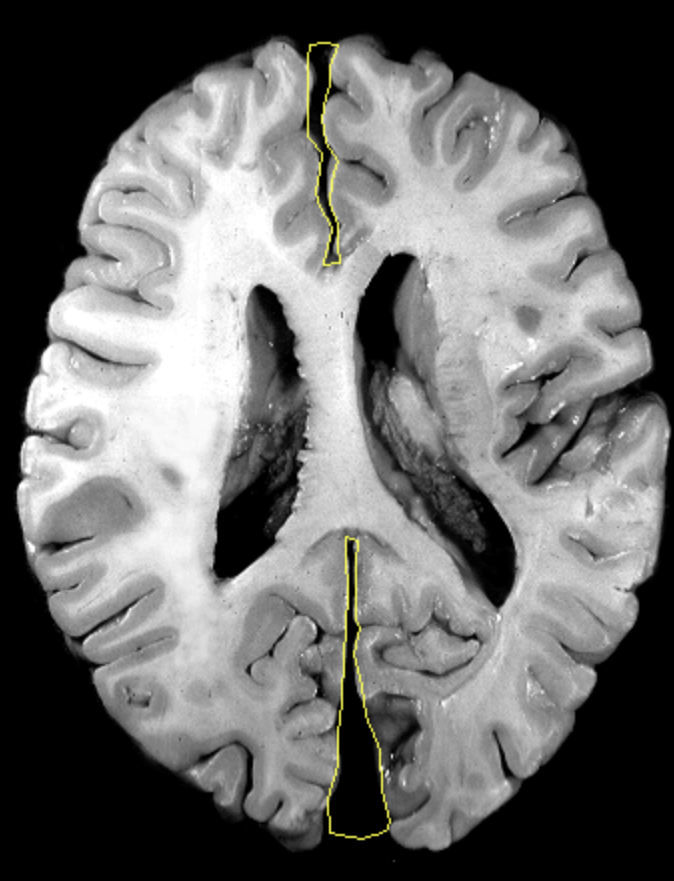 <p>What is the area highlighted called?</p>