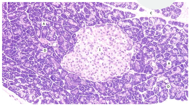 <p>What is I,A,D and C</p>