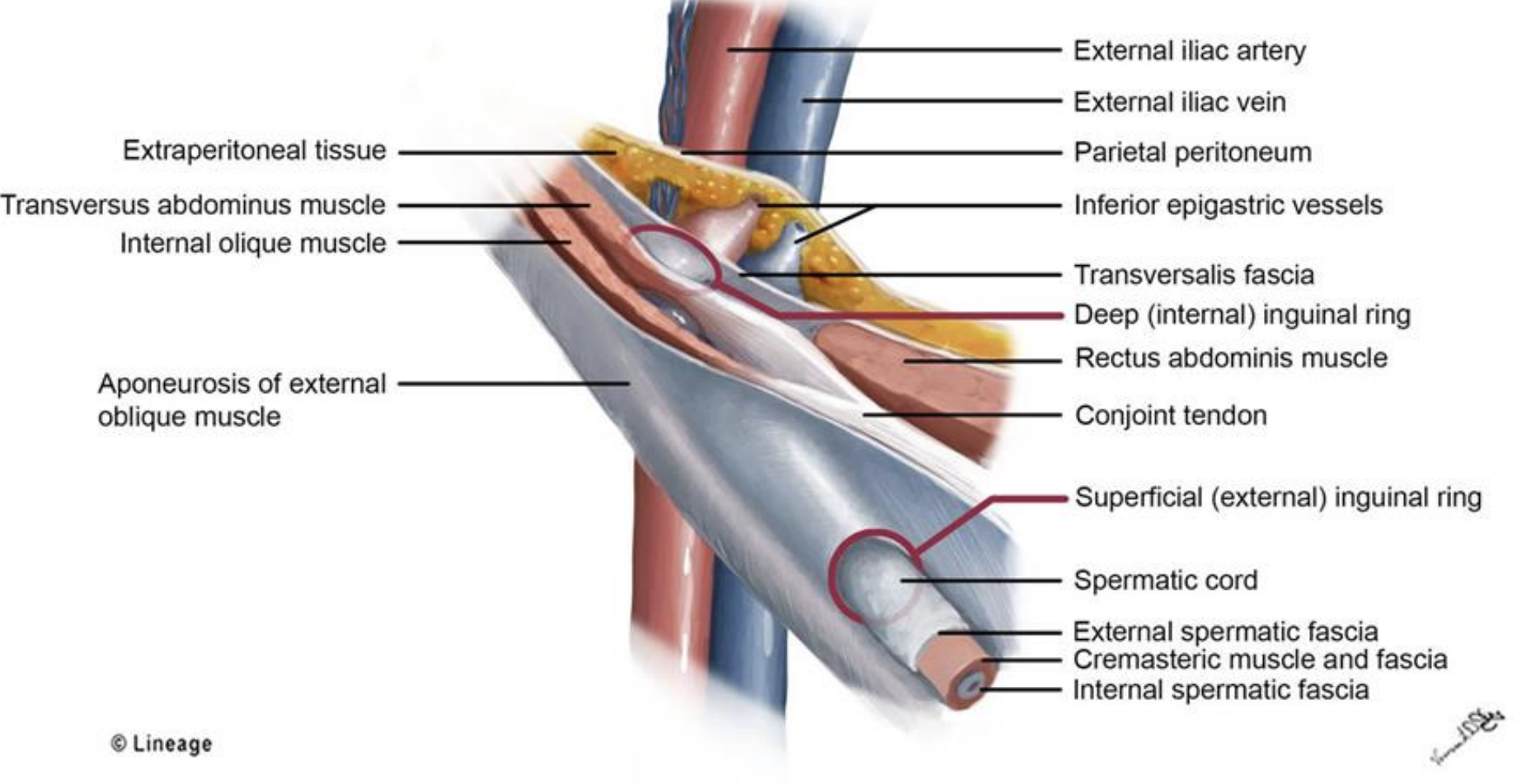 <p>●The inguinal ligament is a fibrous band connecting the anterior superior iliac spine to the pubic tubercle of the pelvis. It marks the junction between pelvis and lower extremity </p><p>● The inguinal canal is formed by fibrosis structures and sits on the medial half of the inguinal ligament</p><p></p><p><strong>Contents of Inguinal Canal</strong></p><p><strong>● Spermatic cord (biological males)</strong></p><p><strong>● Round ligament (biological females)</strong></p><p><strong>● Ilioinguinal nerve</strong></p><p><strong>● Genital branch of genitofemoral nerve</strong></p>