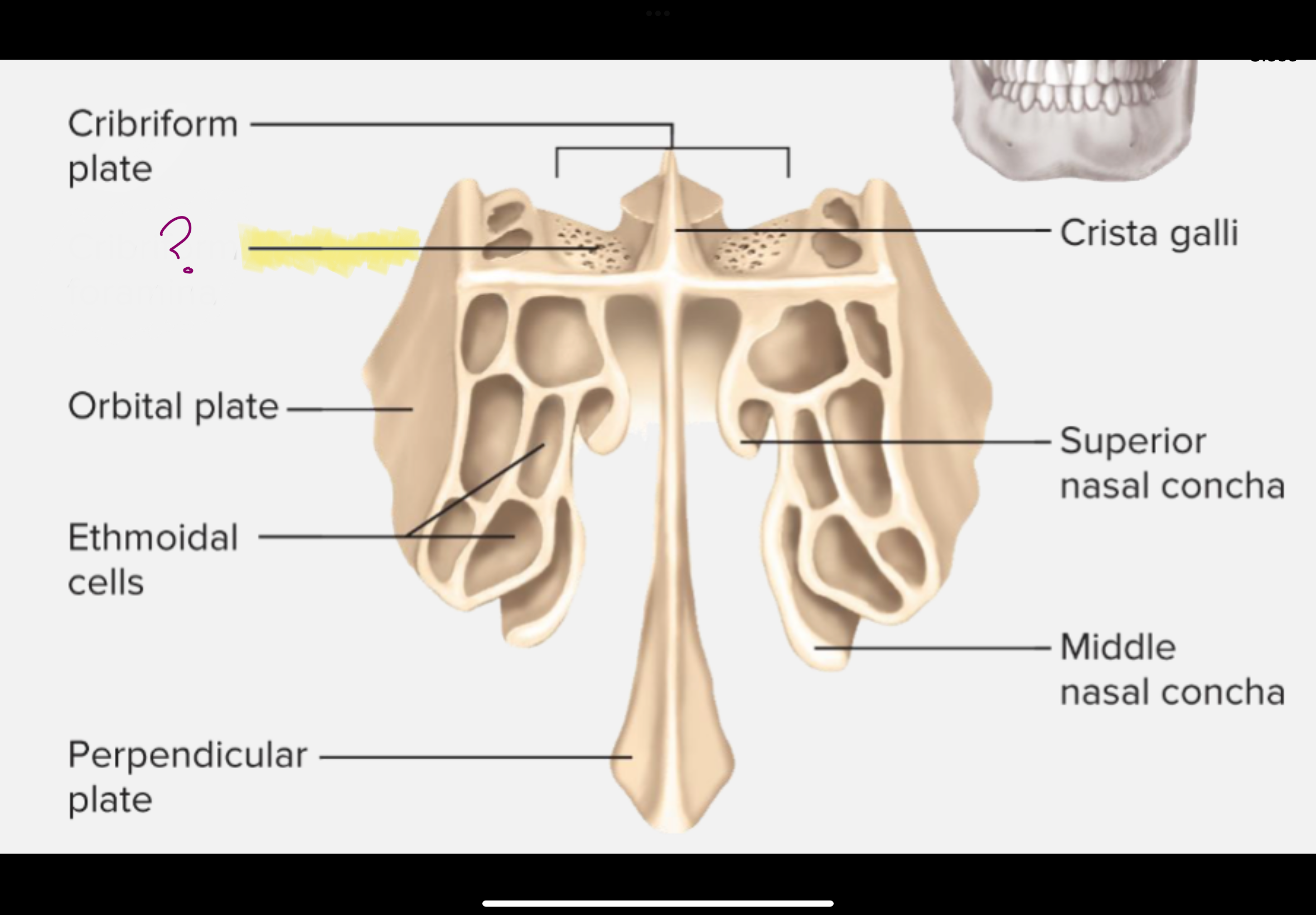 knowt flashcard image