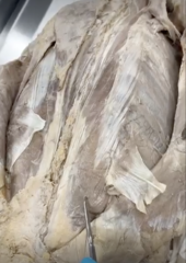 <p>Name the Muscle</p><p>- specific area of iliocostalis</p>