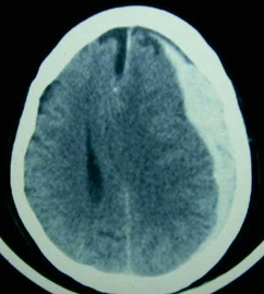 <p>Con la siguiente imagen, cual seria su diagnostico probable </p>