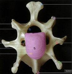 <p>What is labeled with a purple circle?</p>