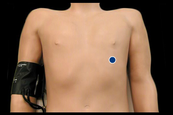 <p>Name this Pulse Site:</p><p>(Chest)</p>