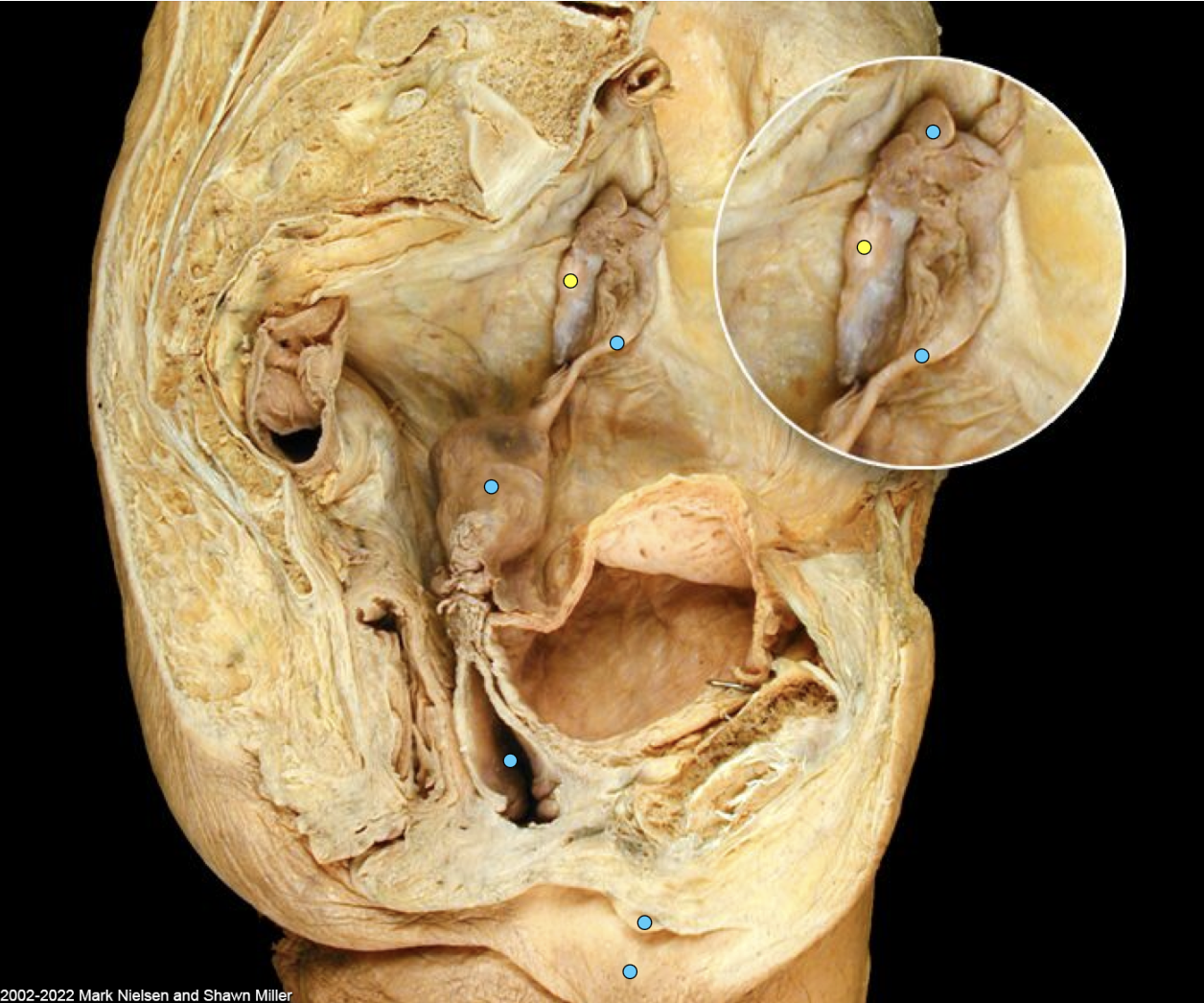 term image