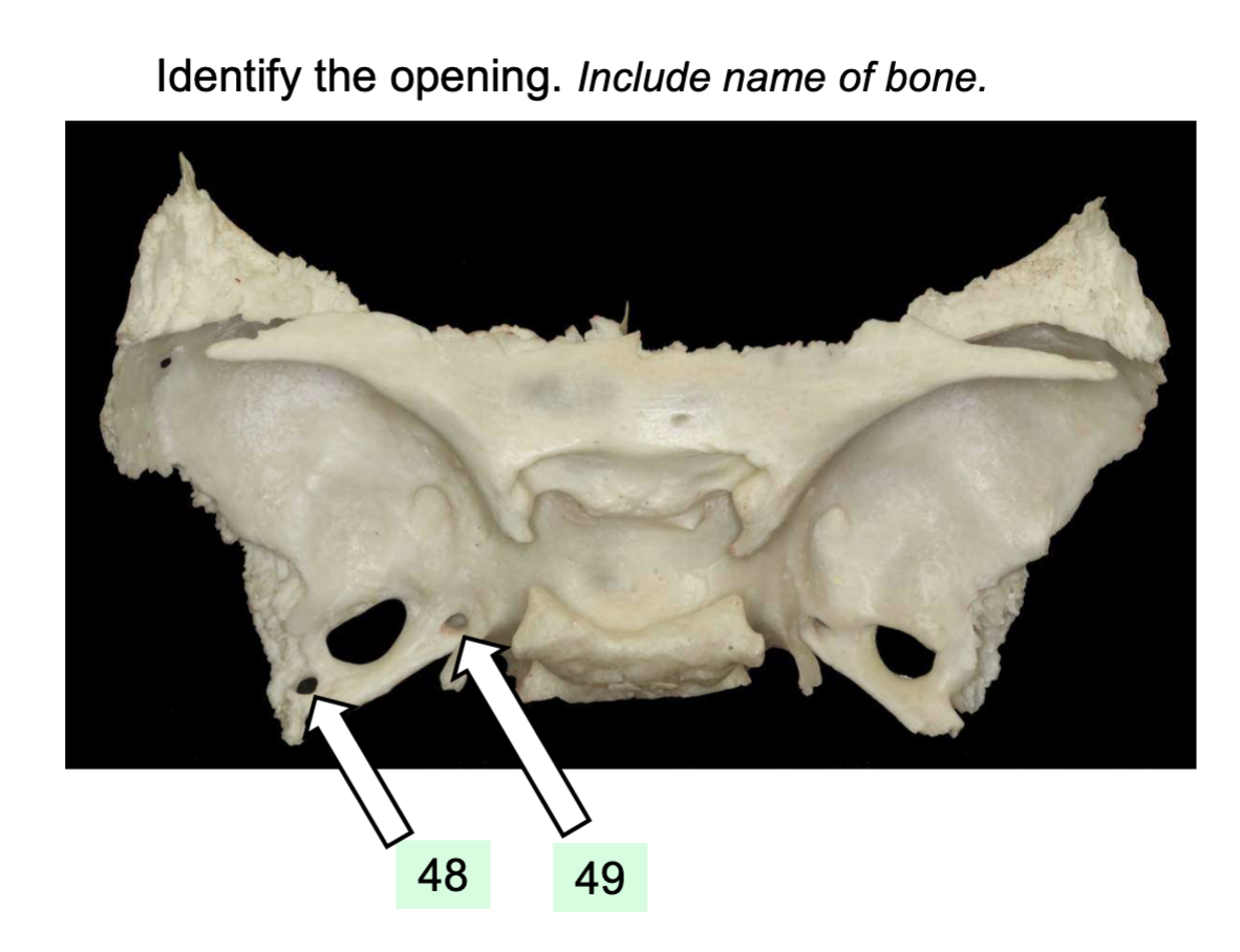 term image