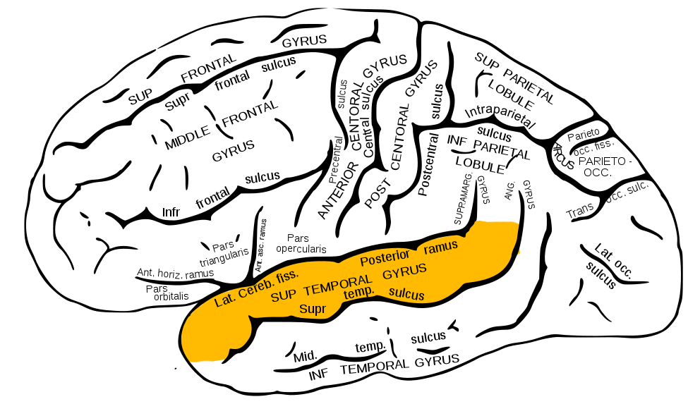 <p>Superior Temporal Gyrus (bump)</p>